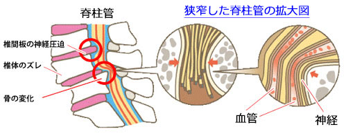 kyousaku-zu1.jpg