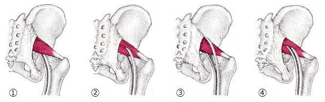 パターン パターン